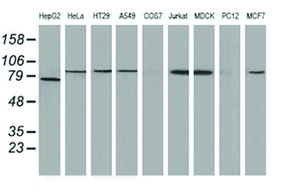Anti-CTNNB1 Mouse Monoclonal Antibody [clone: OTI2F6]