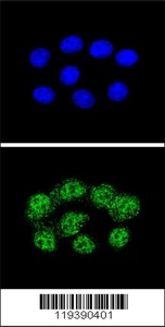 Anti-MSH2 Rabbit Polyclonal Antibody (APC (Allophycocyanin))