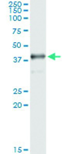 Anti-SDSL Antibody Pair