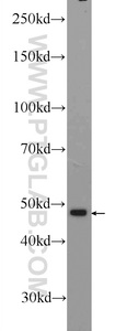 Anti-ZNF323 Rabbit Polyclonal Antibody
