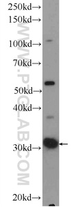 Anti-C11ORF54 Rabbit Polyclonal Antibody