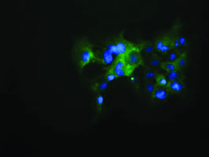 Anti-KEAP1 Mouse Monoclonal Antibody [clone: OTI1G2]