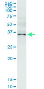Anti-ANXA5 Polyclonal Antibody Pair