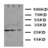 Western blot analysis of Lane 1: HELA Cell Lysate, Lane 2: SMMC Cell Lysate, Lane 3: SW620 Cell Lysate using FADD antibody.