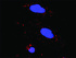 Anti-TP53 + PPP2R5C Antibody Pair