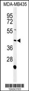Anti-NOXA1 Rabbit Polyclonal Antibody (APC (Allophycocyanin))