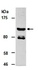 Western blot analysis of total cell extracts from human Hela using KDM3A antibody