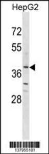 Anti-OR2K2 Rabbit Polyclonal Antibody (HRP (Horseradish Peroxidase))