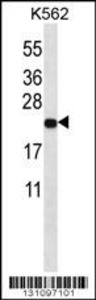 Anti-MT-ND3 Rabbit Polyclonal Antibody