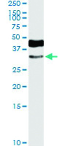 Anti-HOXD8 Rabbit Polyclonal Antibody