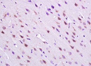 Immunohistochemical analysis of rat brain cell with SEMA6D antibody.