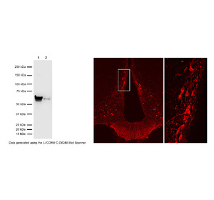 Left: WB analysis of TH expression in PC12 cells (Lane 1: 6 µg) and mouse brain (Lane 2: 40 µg). Right: Detection of TH-IR in tuberoinfundibular dopaminergic neurons in rat hypothalamic arcuate nucleus by IHC. Photo courtesy of Dr. E. Hrabovszky, Hungarian Academy of Sciences, Budapest, Hungary.