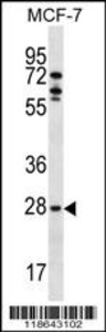 Anti-MLF1 Rabbit Polyclonal Antibody (FITC (Fluorescein Isothiocyanate))