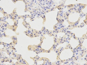 Immunohistochemical analysis of formalin-fixed and paraffin-embedded rat lung tissue using KPNA1 antibody (primary antibody dilution at 1:200)