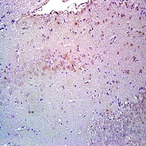 Immunohistochemical analysis of formalin-fixed and paraffin embedded rat brain tissue (Dilution at:1:200) using MEIS1 antibody