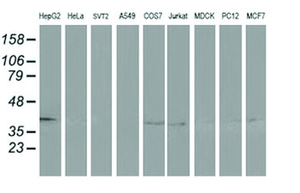 Anti-ADH1B Mouse Monoclonal Antibody [clone: OTI5D7]