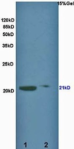 Westerm blot analysis of rat brain lysates(Lane1, 30ug),rat kidney lysates(Lane2, 30ug) using KCNMB1 antibody at 1:200 dilution