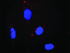 Anti-PTPRR + MAPK1 Antibody Pair