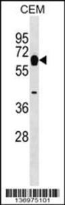 Anti-MYOT Rabbit Polyclonal Antibody (PE (Phycoerythrin))