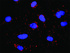 Anti-CD74 + HLA-DQA1 Antibody Pair