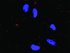 Anti-BIRC3 + TRAF1 Antibody Pair