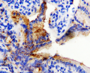 Anti-HSP60 Rabbit Polyclonal Antibody