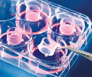 Cell culture inserts