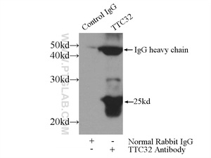 Anti-TTC32 Rabbit Polyclonal Antibody