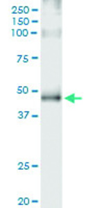Anti-ADRB2 Polyclonal Antibody Pair