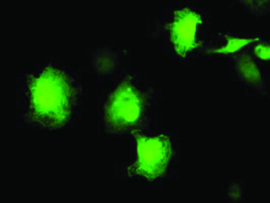 Anti-EIF2B3 Mouse Monoclonal Antibody [clone: OTI2D2]