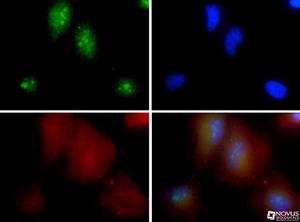 Anti-NPM1 Rabbit Polyclonal Antibody
