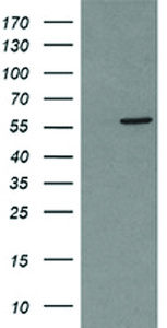 Anti-PPAT Mouse Monoclonal Antibody [clone: OTI1D9]