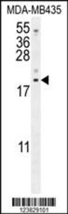 Anti-LYRM4 Rabbit Polyclonal Antibody (PE (Phycoerythrin))