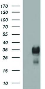 Anti-TMX1 Mouse Monoclonal Antibody [clone: OTI1A4]