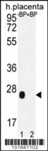 Anti-OR2J3 Rabbit Polyclonal Antibody (HRP (Horseradish Peroxidase))