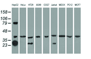 Anti-QPRT Mouse Monoclonal Antibody [clone: OTI4E5]
