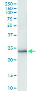 Anti-ARL11 Polyclonal Antibody Pair