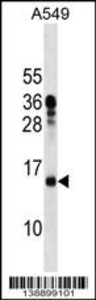 Anti-MRPL11 Rabbit Polyclonal Antibody (HRP (Horseradish Peroxidase))
