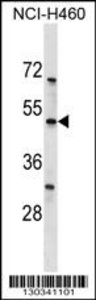 Anti-KCNK12 Rabbit Polyclonal Antibody (AP (Alkaline Phosphatase))