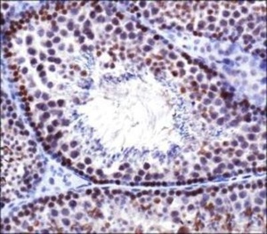 Anti-TP53BP1 Rabbit Polyclonal Antibody (DyLight® 650)