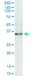 Anti-ANXA1 Polyclonal Antibody Pair