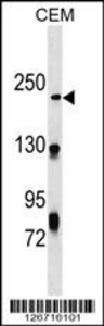 Anti-NHSL1 Rabbit Polyclonal Antibody (FITC (Fluorescein Isothiocyanate))