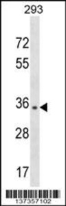 Anti-NUBP1 Rabbit Polyclonal Antibody (FITC (Fluorescein Isothiocyanate))