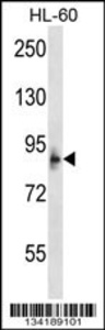 Anti-MCPH1 Rabbit Polyclonal Antibody (APC (Allophycocyanin))