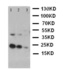 Western blot analysis of Lane 1: Recombinant Human SCF Protein 10ng, Lane 2: Recombinant Human SCF Protein 5ng, Lane 3: Recombinant Human SCF Protein 2.5ng using KITLG antibody