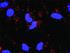 Anti-NFKB1 + STAT3 Antibody Pair