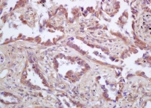 Immunohistochemical analysis of formalin-fixed paraffin embedded mouse spleen tissue using AIP1 p53 antibody (dilution at 1:200)