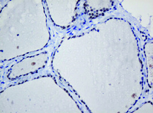 Anti-TRMT2A Mouse Monoclonal Antibody [clone: OTI1G8]