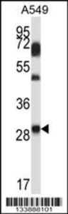 Anti-NNMT Rabbit Polyclonal Antibody