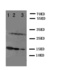 Western blot analysis of Lane 1: Recombinant Human IL-2 Protein 10ng, Lane 2: Recombinant Human IL-2 Protein 5ng, Lane 3: Recombinant Human IL-2 Protein 2.5ng using IL2 antibody.